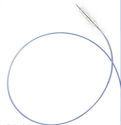 Catheter Balún Scórála Barty